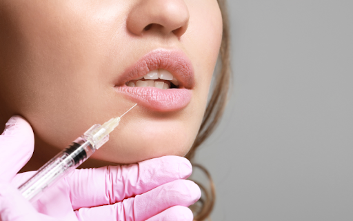 Aesthetic procedure in progress with gloved professional administering lip filler to enhance volume