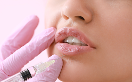 A close-up of a woman receiving a cosmetic lip injection