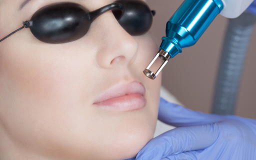 A woman wearing protective goggles undergoes a laser treatment on her upper lip